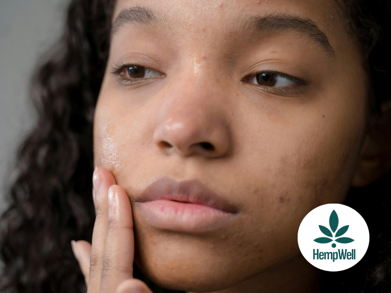 CBD & skincare